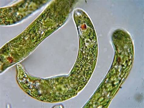  Euglena:  The Tiny Swimming Algae That Blurs the Line Between Plant and Animal!